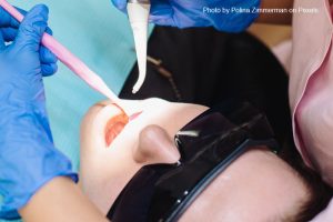 Fallbrook dentist, tooth decay treatment